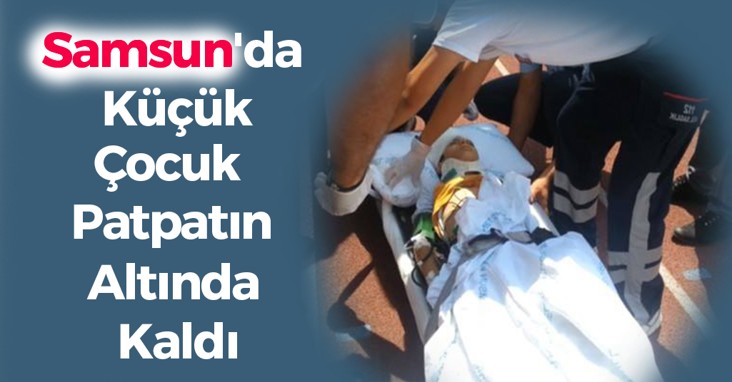 Samsun'da Küçük Çocuk Patpatın Altında Kaldı