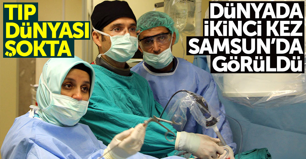 Dünyada ikinci kez Samsun'da rastlandı