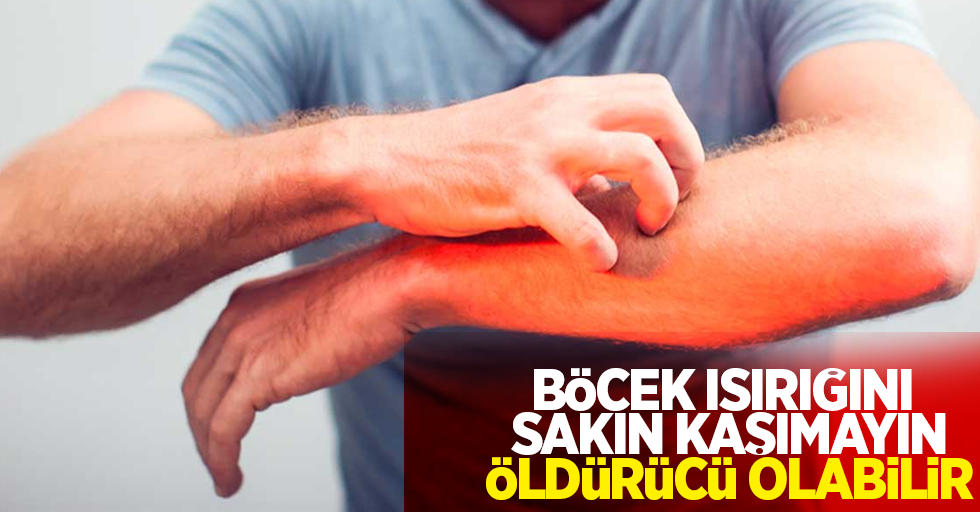 Böcek ısırığını sakın kaşımayın: Öldürücü olabilir!