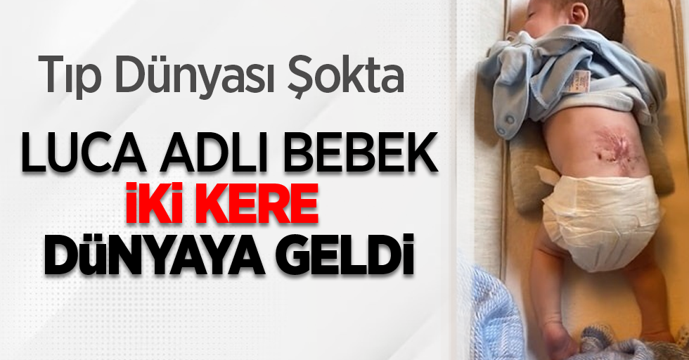 Tıp dünyası şokta: Luca adlı bebek iki kere dünyaya geldi