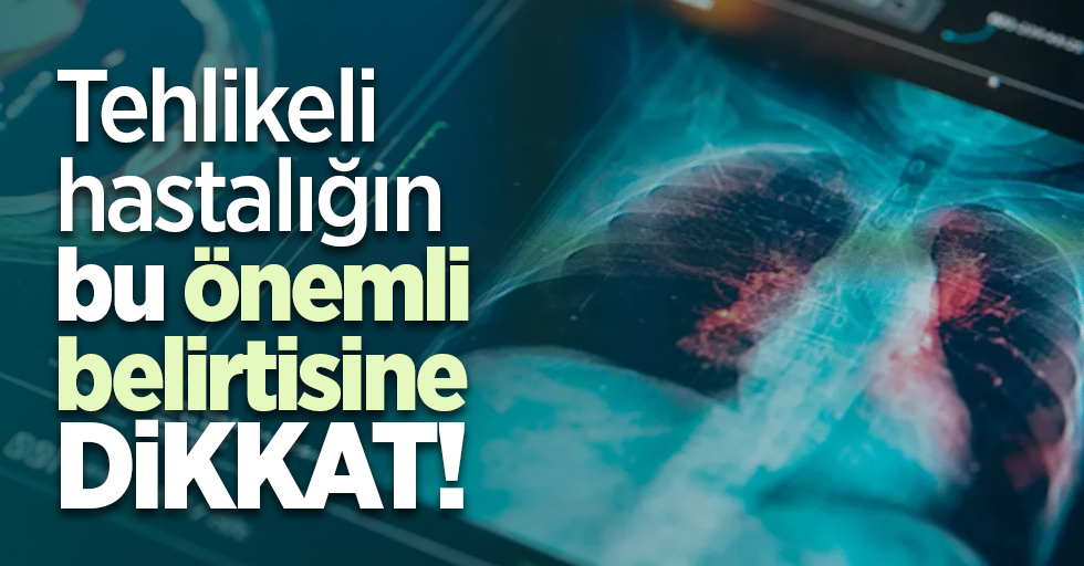 Tehlikeli hastalığın bu önemli belirtisine dikkat!