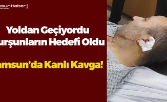 Samsun’da Bir Kişi Kazara Tüfekle Vuruldu