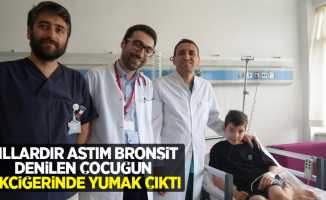 Yıllardır astım bronşit denilen çocuğun akciğerinde yumak çıktı