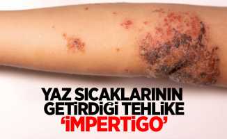 Yaz sıcaklarının getirdiği tehlike ‘impertigo’