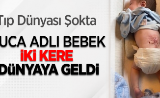 Tıp dünyası şokta: Luca adlı bebek iki kere dünyaya geldi