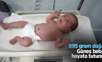 895 gram doğan Güneş bebek hayata tutundu