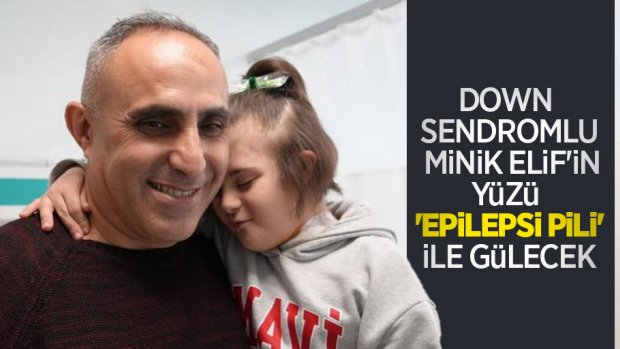 Down sendromlu minik Elif'in yüzü 'epilepsi pili' ile gülecek